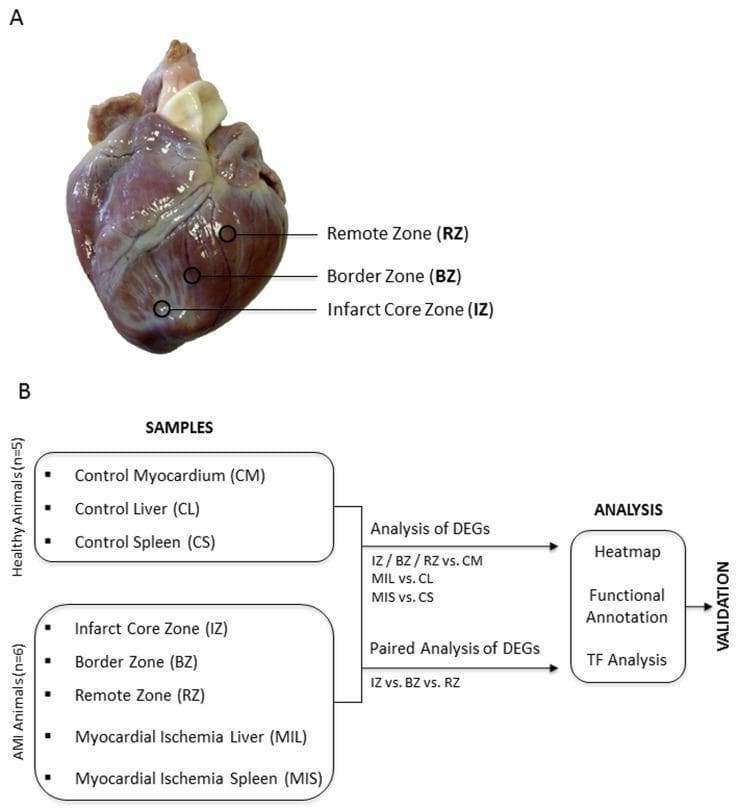 This educational graphic illustrates an experimental model of myocardial infarction (MI) in a porcine subject. Panel A is a clinical photograph of a porcine heart post-left anterior descending (LAD) artery occlusion. It displays three demarcated zones of clinical significance: the Infarct Core Zone (IZ) located at the apex, showing dark discoloration indicative of necrotic tissue; the Border Zone (BZ), a transitional area adjacent to the infarct; and the Remote Zone (RZ), appearing as healthy, pinkish-red myocardium distal to the site of occlusion. Panel B is a structured study design flowchart. It outlines the comparative analysis of differentially expressed genes (DEGs), transcription factors (TF), and functional annotations between samples from healthy control animals (myocardium, liver, spleen) and animals with Acute Myocardial Infarction (AMI). The diagram highlights the methodology used to investigate the systemic host response and genomic alterations across the IZ, BZ, and RZ, facilitating the study of infarct healing and inter-organ communication during cardiac ischemia.