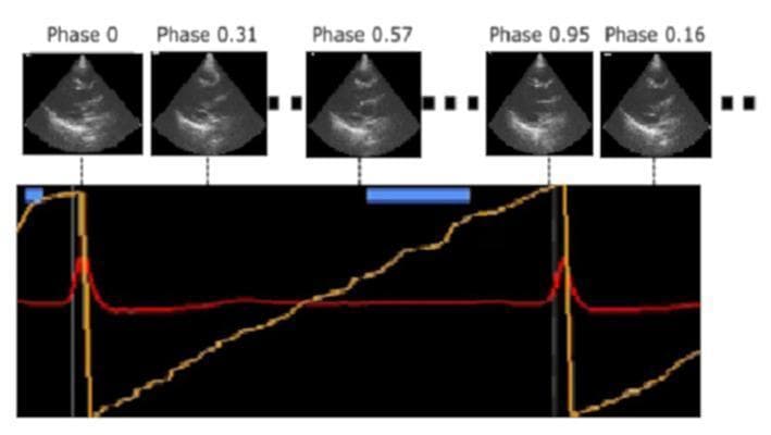 This composite educational graphic illustrates the real-time identification of cardiac cycle phases using an artificial intelligence algorithm integrated with echocardiography. The top row features a temporal sequence of five B-mode ultrasound frames, likely in a parasternal long-axis view, labeled sequentially by cardiac phase (ranging from Phase 0 to Phase 0.95 and returning to Phase 0.16). These frames demonstrate the dynamic anatomical changes of the heart chambers throughout diastole and systole. Below the images is a synchronized graph displaying two key traces: a red Electrocardiogram (ECG) trace showing the R-peak intervals, and a yellow linear mapping trace. The yellow trace represents a normalized temporal scale (0 to 1) between consecutive R-waves. Vertical dashed lines connect specific points on the linear mapping to their corresponding ultrasound frames, demonstrating how the AI algorithm assigns a specific cardiac phase to each ultrasound frame based on its exact temporal position within the R-R interval. This visualization highlights the application of computer-aided diagnostic tools in automating the gating and temporal alignment of cardiac imaging.