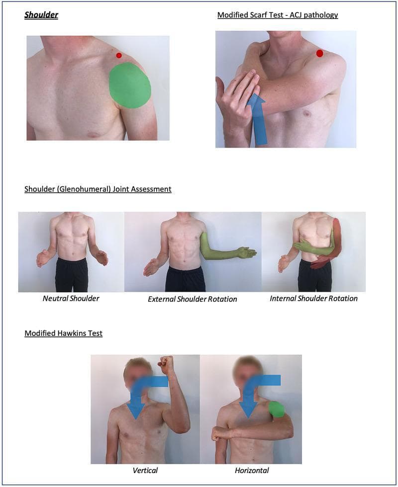 Educational clinical photograph compilation illustrating physical examination maneuvers for shoulder assessment. The content is organized into four main sections: 1. Shoulder (Basics): Highlights the deltoid region with a green overlay and a red dot indicating the acromioclavicular joint (ACJ). 2. Modified Scarf Test: Demonstrates cross-body adduction to assess ACJ pathology, featuring a blue directional arrow and a red dot at the ACJ. 3. Glenohumeral Joint Assessment: Displays the patient in neutral, external rotation (highlighted in green for normal range of motion), and internal rotation (highlighted in red for restricted or abnormal motion). 4. Modified Hawkins Test: Shows two variations for impingement assessment—a vertical approach with the arm abducted to 90 degrees and internally rotated, and a horizontal approach with the arm adducted across the midline. Blue arrows indicate the direction of force and rotation. This resource uses a color-coding convention where green overlays typically represent normal findings or anatomical target zones, and red signifies potential pathology or restricted range of motion. It is designed for clinical training and telemedicine frameworks.