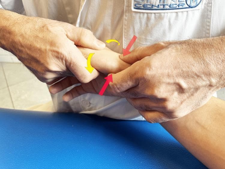 This clinical photograph illustrates a manual therapy technique, specifically Maitland's passive accessory mobilization, applied to the trapeziometacarpal (TMj) joint of the right hand. The patient's forearm is resting in a neutral position on a blue treatment surface. The therapist utilizes a bimanual grip; the right hand stabilizes the patient's wrist and carpal region, while the left hand performs the mobilization. The therapist's left thumb and index finger encircle the base of the first metacarpal. Overlaid graphical indicators clarify the mechanics: straight red arrows demonstrate an anteroposterior (or posterior-anterior) gliding force applied to the basal joint, and curved yellow arrows represent rotational or oscillatory movement components. This procedural image demonstrates a common conservative management approach for rhizarthrosis (trapeziometacarpal osteoarthritis), aimed at reducing pain and improving accessory joint mobility through small-amplitude oscillations.