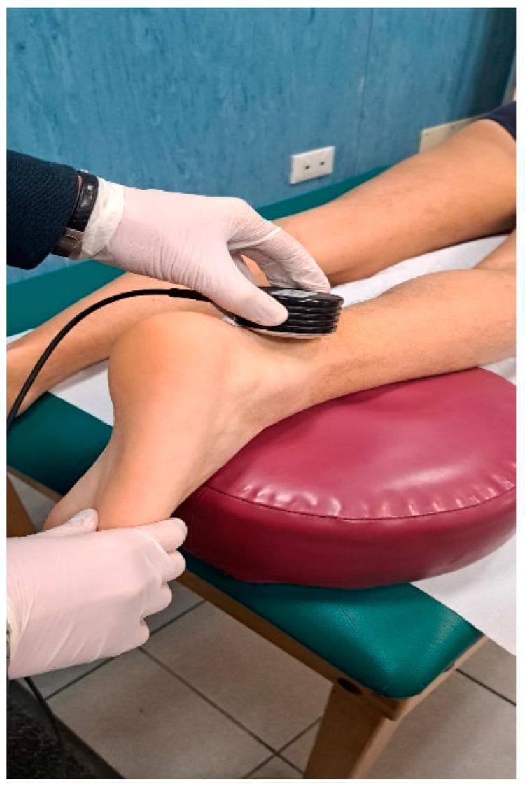 A clinical procedural photograph demonstrating the application of therapeutic ultrasound for mid-portion Achilles tendinopathy (AT). The image shows a patient in a prone or supine-modified position with the lower leg elevated on a maroon-colored bolster for comfort and anatomical access. A healthcare provider, wearing white examination gloves, is shown applying a black, circular ultrasound therapy probe to the posterior aspect of the ankle. The probe is positioned directly over the mid-portion of the Achilles tendon, approximately 2–6 cm proximal to the calcaneal insertion. The practitioner's second hand is seen stabilizing the heel to maintain the ankle in a neutral or slightly dorsiflexed position during the procedure. This modality is utilized in physical therapy and sports medicine to promote healing, increase local blood flow, and provide pain relief in patients with chronic tendinosis or degenerative tendon changes. The setting is a professional clinical environment featuring a padded treatment table and standard medical equipment.