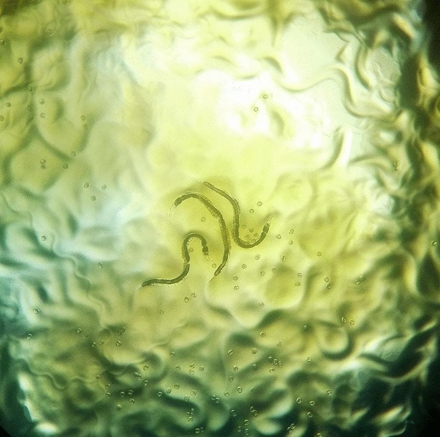 This diagnostic image shows a macroscopic view of an agar plate culture used for the detection of Strongyloides stercoralis, a human pathogenic nematode. The culture medium has a translucent, yellowish-green appearance with a highly irregular, wrinkled surface texture. These surface furrows and grooves represent characteristic 'larval tracks,' which are formed as the motile larvae migrate across the agar surface, often carrying bacteria along their path that then grow into visible trails. Centrally located are two slender, elongated adult worms exhibiting a curved morphology. Scattered throughout the medium are numerous small, circular, translucent structures consistent with parasite ova. This agar plate culture technique is a highly sensitive diagnostic method for identifying strongyloidiasis in clinical stool samples, as the visualization of these tracks and parasite life stages (larvae, adults, and eggs) provides definitive evidence of infection.