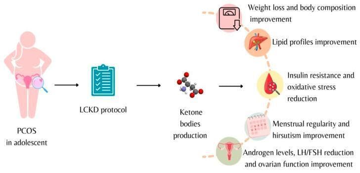 A pathophysiology diagram illustrating the clinical impact of a Low-Calorie Ketogenic Diet (LCKD) protocol on adolescents with Polycystic Ovary Syndrome (PCOS). The schematic follows a linear progression from left to right. It begins with an adolescent figure representing a PCOS diagnosis, highlighting the pelvic region. The next stage depicts the 'LCKD protocol' intervention, which leads to the biochemical phase of 'Ketone bodies production,' represented by a molecular model. The final section branches into multiple physiological benefits, categorized by icons: a scale indicating weight loss and body composition improvement; a liver icon for lipid profile improvement; a blood drop for reduction in insulin resistance and oxidative stress; a calendar for menstrual regularity and hirsutism improvement; and a reproductive system icon for the reduction of androgen levels and LH/FSH ratios, alongside improved ovarian function. This infographic summarizes the multi-systemic metabolic and endocrine benefits of nutritional ketosis in managing PCOS symptoms.