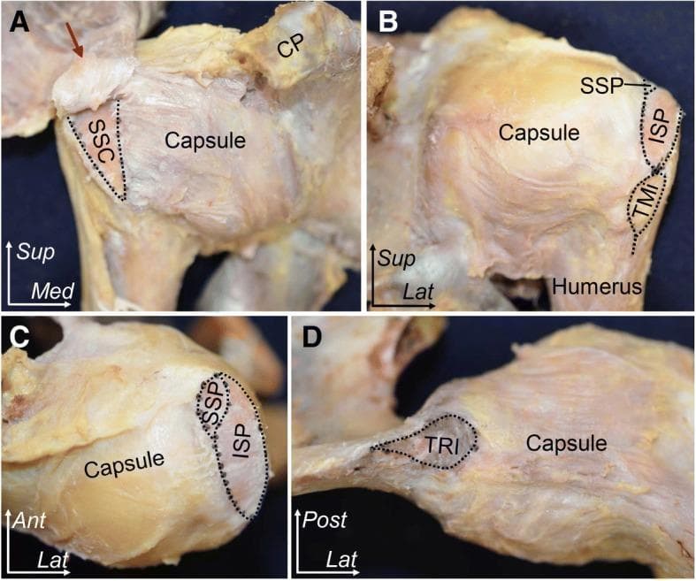 This composite of four clinical cadaveric photographs (A–D) illustrates the anatomy of the human shoulder joint, focusing on the insertions of the rotator cuff muscles and the articular capsule. The images use black dotted lines to delineate footprint locations and arrows to indicate specific ligamentous connections. (A) Anterior aspect: Displays the subscapularis (SSC) insertion on the lesser tubercle and its superior relationship to the coracohumeral ligament (red arrow) and coracoid process (CP). (B) Posterior aspect: Highlights the sequential insertions of the supraspinatus (SSP), infraspinatus (ISP), and teres minor (TMi) along the greater tubercle of the humerus. (C) Superior aspect: Provides a bird's-eye view of the SSP and ISP footprints, emphasizing their anteroposterior orientation atop the humeral head. (D) Inferior aspect: Demonstrates the origin of the long head of the triceps brachii (TRI) at the infraglenoid tubercle and its proximity to the inferior articular capsule. These views collectively demonstrate the footprint morphology and spatial relationships critical for orthopedic surgery and rotator cuff repair.