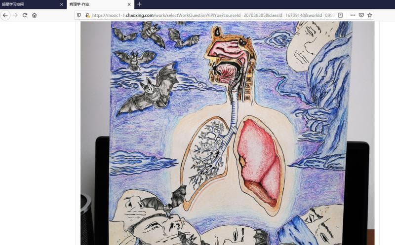 This educational anatomical illustration combines a sagittal section of the upper respiratory tract with a coronal view of the lower respiratory system, created as a student project. The superior portion depicts the nasal cavity, oral cavity, pharynx, and larynx in cross-section. Below, the trachea descends and bifurcates into the primary bronchi. The lungs are shown with asymmetrical detailing: the right lung is rendered in a solid pink/red hue indicating tissue parenchyma, while the left lung features a detailed schematic of the bronchial tree and alveolar branching patterns. The central anatomical figure is set within a light-colored torso silhouette. Surrounding the anatomical drawing are symbolic elements including bats and several human faces in states of rest or mask-wearing, set against a blue, wavy background. This visual serves as a medical student's creative synthesis of respiratory anatomy and pathology, likely contextualizing the COVID-19 pandemic and zoonotic disease transmission. The medical focus is on the structural continuity between the upper and lower respiratory tracts.