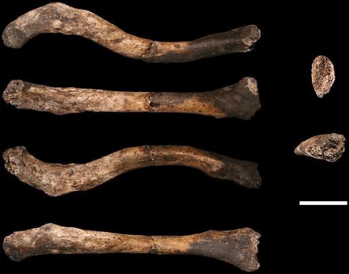 This clinical specimen image displays six views of a right human clavicle (U.W. 102a-021). The left column provides superior, anterior, inferior, and posterior longitudinal views, while the right column shows the medial and lateral articular surfaces. The specimen demonstrates a typical S-shaped curvature and measures approximately 10-12 cm in length, indicated by a 2 cm scale bar. Visible pathology and taphonomic features include a midshaft fracture where two pieces have been conjoined, and missing articular surfaces at the sternal (medial) end, which exposes the underlying trabecular bone structure. The acromial (lateral) end shows minor damage. The bone surface exhibits significant mineral staining, with dark coatings on the anterior-sternal half and patchy black staining on the acromial half. Fine, hairline longitudinal cracks are present across the acromial portion, consistent with post-mortem sediment loading and moisture fluctuations. This anatomical specimen is used in medical education to illustrate hominin skeletal morphology and taphonomic assessment of fossilized human remains.