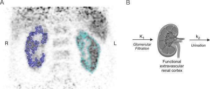This composite image demonstrates the methodology for assessing Glomerular Filtration Rate (GFR) using dynamic PET imaging. Panel A shows a frontal view of an early-frame PET scan of the kidneys. The functional renal cortex is segmented using 3D auto iso-contouring; the right kidney (labeled 'R') is outlined in dark blue, and the left kidney (labeled 'L') is outlined in cyan. This segmentation is crucial for constructing renal cortical time-activity curves (TACs). Panel B illustrates a schematic representation of a single-compartment tracer kinetic model used for GFR quantification. The model consists of an input rate constant, K1, representing glomerular filtration into the functional extravascular renal cortex (depicted as an anatomical kidney diagram), and an output rate constant, k2, representing tracer elimination via urination. This visual summarizes both the anatomical region of interest (ROI) selection in diagnostic nuclear medicine and the underlying physiological modeling required for renal functional assessment.