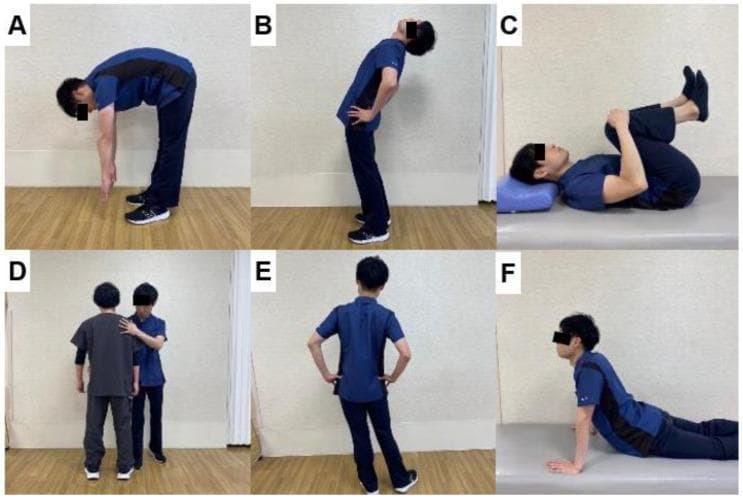 A composite of six clinical photographs (A-F) illustrating the McKenzie Method of Mechanical Diagnosis and Therapy (MDT) exercises for lower back pain rehabilitation. (A) Standing Flexion: The patient bends forward at the hips with straight knees, reaching toward the floor. (B) Standing Extension: The patient stands with hands on the lumbar region, arching the spine backward. (C) Supine Flexion: The patient lies on their back, drawing both knees toward the chest (knee-to-chest position). (D) Therapist-Assisted Side Glide: A clinician provides manual stabilization at the shoulder and lateral pressure at the pelvis to correct lateral shift. (E) Standing Side Glide (Self-correction): The patient performs a lateral pelvic shift against a wall or independently with hands on hips. (F) Lying Extension (Prone Press-up): The patient lies prone and uses their arms to push the upper body upward while keeping the pelvis in contact with the surface. These exercises are used for centralization of symptoms and improving spinal mobility in musculoskeletal physical therapy.