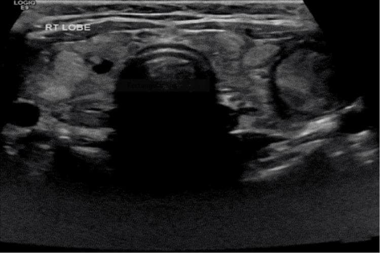 Hugging Face pmc clinical VQA raw