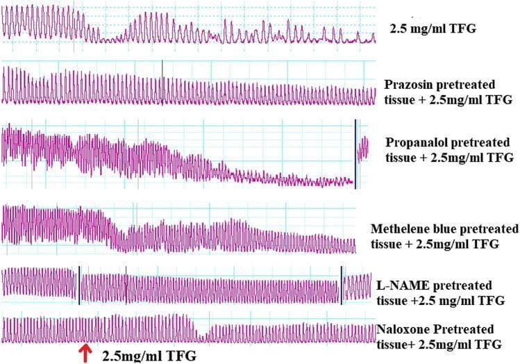 A multi-panel physiological recording (PowerLab tracing) demonstrating the effect of Tylosema fassoglense (TFG) extract on the spontaneous contractility of isolated smooth muscle tissue (jejunal segments). The tracings represent pharmacodynamic responses under various pretreatment conditions including an alpha-adrenergic antagonist (prazosin), a beta-adrenergic antagonist (propranolol), a guanylyl cyclase inhibitor (methylene blue), a nitric oxide synthase inhibitor (L-NAME), and an opioid antagonist (naloxone). The first tracing (2.5 mg/ml TFG) shows a reduction in contraction amplitude over time. The propranolol-pretreated panel exhibits a marked progressive decrease in both frequency and amplitude. Prazosin-pretreated tissue maintains high-frequency oscillations, while L-NAME pretreatment results in sustained oscillations of lower amplitude compared to the control. These comparative tracings are used to evaluate the mechanism of action of the plant extract, specifically its spasmolytic activity and interactions with different autonomic and biochemical signaling pathways.
