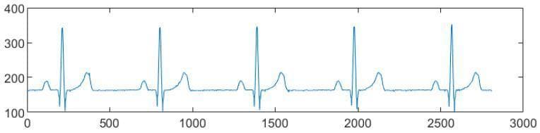This diagnostic image displays a reconstructed single-lead electrocardiogram (ECG) tracing, specifically identifying a normal sinus rhythm from lead II at a rate of 60 beats per minute. The waveform is presented on a graph with an x-axis representing samples (time) and a y-axis representing amplitude in arbitrary units. The tracing illustrates five complete cardiac cycles, characterized by highly regular R-R intervals. Visually distinct components include a rounded P wave, a sharp and narrow QRS complex with a prominent R-peak reaching approximately 350 units, and a broader, slightly asymmetrical T wave. The isoelectric baseline is positioned at approximately the 160 mark. The morphology demonstrates classic electrophysiological features: a short QRS duration relative to the T wave and consistent amplitudes across cycles, signifying hemodynamic stability. This visual serves as an educational model for signal processing and the fundamental morphological identification of cardiac electrical activity in a clinical diagnostic context.