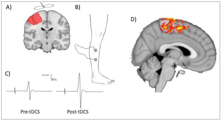 Educational multi-panel illustration detailing neurophysiological assessment techniques for transcranial direct current stimulation (tDCS) of the lower limb motor cortex. Panel A: Coronal brain diagram with red shading identifying the targeted primary motor cortex (M1) area for anodal tDCS. Panel B: Anatomical illustration of a human lower limb showing electrode placement for surface electromyography (sEMG) over the tibialis anterior muscle. Panel C: Comparison chart of motor-evoked potential (MEP) traces recorded via transcranial magnetic stimulation (TMS). The traces illustrate a significant increase in peak-to-peak amplitude from 'Pre-tDCS' to 'Post-tDCS,' signifying enhanced corticospinal excitability. Panel D: Sagittal neuroimaging slice (fMRI) displaying a localized blood oxygen level-dependent (BOLD) signal in the paracentral lobule, corresponding to neural activation in the lower limb motor representation. This composite graphic demonstrates how electrophysiological (MEP) and hemodynamic (fMRI) markers are used to quantify brain response to neuromodulation therapy in clinical research and rehabilitation, such as post-stroke recovery.
