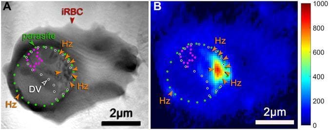 A correlative microscopy study of a human red blood cell infected with Plasmodium falciparum (malaria parasite), featuring two side-by-side images. Image (A) is a soft X-ray tomography (SXT) projection demonstrating high-contrast visualization of carbon-dense structures. Dotted lines delineate the parasite (green), the digestive vacuole (white/black), and a region free of hemozoin (magenta). Hemozoin crystals (Hz) appear as dark-grey, highly absorbent spots pointed out by orange arrows. Image (B) is a corresponding iron X-ray fluorescence (XRF) map of the same cell, aligned to the tomography dataset. This map uses a pseudocolor gradient (blue to red) to represent iron concentration intensity. High iron fluorescence (red/orange) corresponds precisely to the locations of hemozoin crystals identified in image A, illustrating the sequestration of iron within the parasite's digestive vacuole as a byproduct of hemoglobin digestion. Both images include a 2μm scale bar, highlighting the morphological and chemical features of a trophozoite-stage infection.