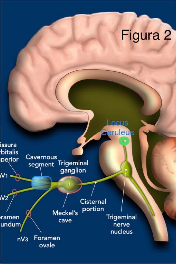 Anatomical diagram of the brain in a sagittal view illustrating the pathway of the trigeminal nerve (CN V). The illustration highlights key anatomical segments and landmarks relevant to neuroanatomy and clinical neurology. Centrally, the trigeminal nerve is traced from its distal branches—V1 (ophthalmic), V2 (maxillary), and V3 (mandibular)—as they exit via the superior orbital fissure, foramen rotundum, and foramen ovale, respectively. Moving proximally, the diagram identifies the cavernous segment (highlighted by a blue oval), the trigeminal ganglion situated within Meckel's cave, and the cisternal portion of the nerve. The nerve is shown entering the brainstem to reach the trigeminal nerve nucleus in the pons. Superior to the nucleus, a green dot marks the locus ceruleus. The diagram provides a clear educational visualization of the transition from peripheral branches to central nuclei, facilitating the study of cranial nerve distribution and relevant neurosurgical corridors.