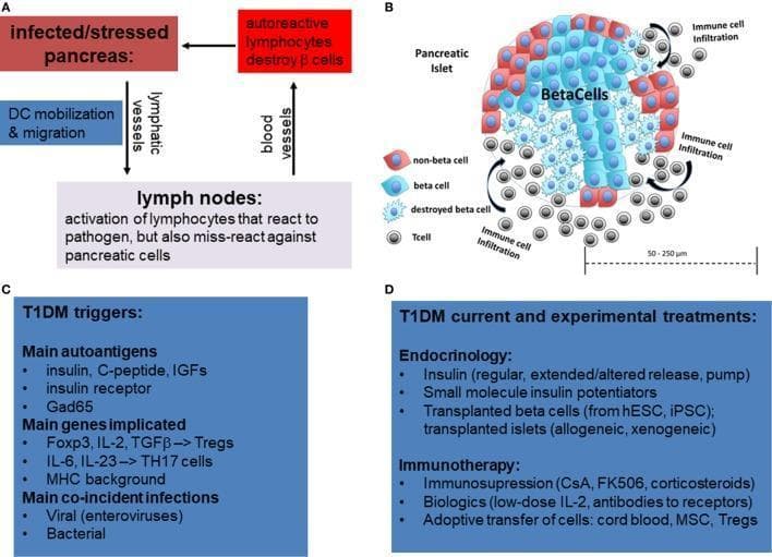 A multi-panel educational graphic illustrating the pathophysiology, triggers, and treatments for Type 1 Diabetes Mellitus (T1DM). Panel A is a flowchart showing the immunological pathway from pancreatic stress to autoreactive lymphocyte-mediated beta cell destruction via dendritic cell (DC) migration to lymph nodes. Panel B provides a pathophysiology diagram of a pancreatic islet (50-250 µm). It depicts immune cell infiltration (insulitis) by T cells (gray), leading to the destruction of central beta cells (blue) while non-beta cells (red) remain at the periphery. Panel C summarizes T1DM triggers, including autoantigens (insulin, GAD65), genetic factors (Foxp3, MHC background), and co-incident infections (enteroviruses). Panel D lists current and experimental treatments, categorizing endocrinology approaches (insulin pumps, islet transplantation from hESCs/iPSCs) and immunotherapy strategies (corticosteroids, biologics like IL-2, and adoptive cell transfers including Tregs and MSCs). The graphic serves as a comprehensive overview of T1DM etiology and clinical management.