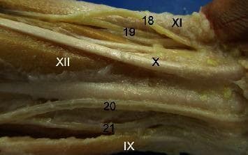 This clinical photograph displays a detailed anatomical dissection of the distal forearm and wrist region in a Macaca fuscata specimen, specifically providing a caudal (posterior) view of the right forelimb. The image highlights the complex neurovascular and musculoskeletal architecture relevant to comparative anatomy. Key arterial structures labeled include the superficial branch of the radialis artery (18), the deep branch of the radialis artery (19), the ulnaris artery profundus ramus (20), and the superficial branch of the ulnaris artery (21). Associated musculature and tendinous structures are also identified, including the Brachioradialis (IX), the tendon of the Palmaris longus (X), the Flexor carpi ulnaris tendon (XI and XIII), and the Flexor digitorum superficialis (XII). The dissection illustrates the distal branching patterns of the radial and ulnar arteries as they transition toward the palmar arches, serving as a model for understanding primate vascular variations and their similarities to human upper limb anatomy. The educational focus is on the spatial relationships between the major arteries of the forearm and the surrounding flexor tendons.