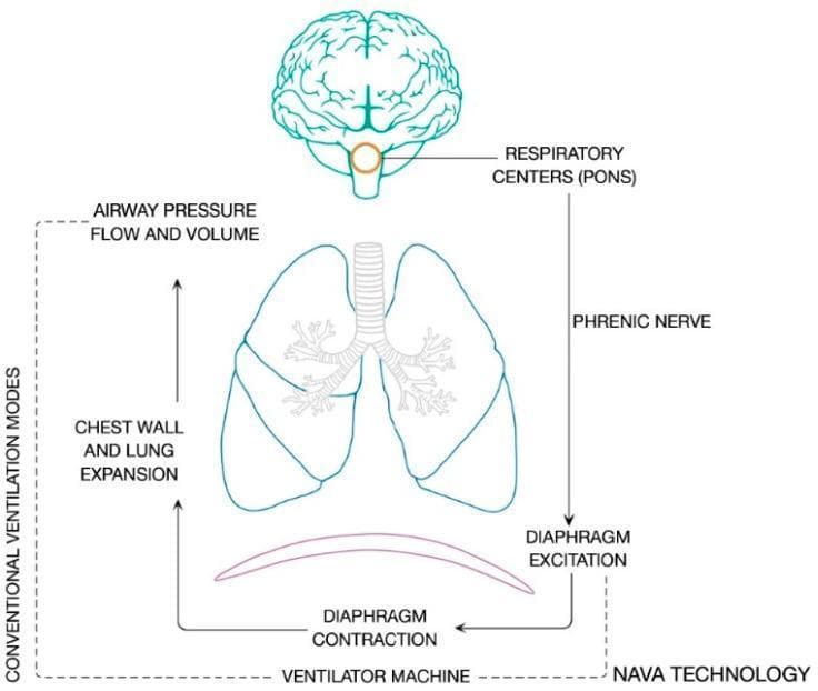 This pathophysiology diagram illustrates the process of neuroventilatory coupling, detailing the pathway from neural drive to mechanical ventilation. At the top, a brain illustration highlights the respiratory centers within the pons as the primary signal origin. An efferent pathway follows the phrenic nerve down to the diaphragm, where it triggers diaphragm excitation and subsequent contraction. This mechanical action leads to chest wall and lung expansion, resulting in measurable changes in airway pressure, flow, and volume. The diagram further incorporates the role of medical technology, showing how a ventilator machine interacts with this loop. It identifies two specific pathways: 'Conventional Ventilation Modes,' which modulate airway pressure, flow, and volume, and 'NAVA Technology' (Neurally Adjusted Ventilatory Assist), which interfaces directly with diaphragm excitation signals. This educational visual provides a comprehensive overview of the physiological drive of breathing and its integration with mechanical ventilatory support, emphasizing the connection between neurological output and respiratory mechanics.