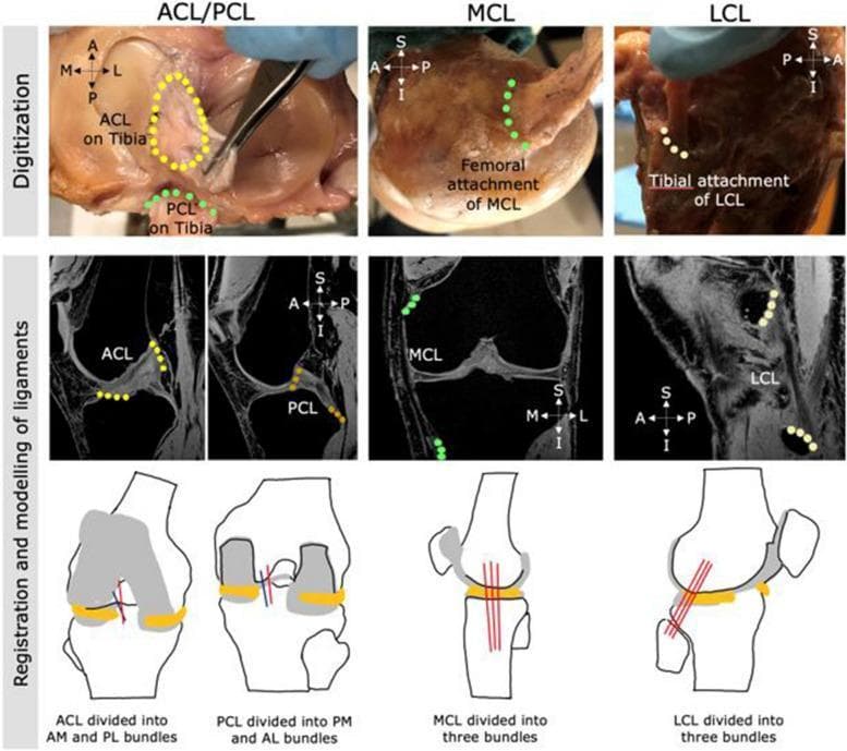 This composite educational image illustrates the multi-step process for digitizing and modeling human knee ligaments—ACL, PCL, MCL, and LCL—for orthopedic research. The top row features clinical photographs of cadaveric dissections where ligaments are digitized using anatomical landmarks: the ACL is highlighted as an oval area on the tibia, while the PCL, MCL, and LCL attachment sites are marked with colored point sequences. The middle row displays T1-weighted or Proton Density MRI scans in sagittal and coronal planes, showing the registration of these digitized points onto medical imaging to define ligamentous paths. The bottom row consists of schematic anatomical diagrams demonstrating the conceptual subdivision of ligaments into functional bundles: the ACL into anteromedial (AM) and posterolateral (PL) bundles; the PCL into posteromedial (PM) and anterolateral (AL) bundles; and the collateral ligaments (MCL and LCL) each into three distinct fiber bundles. This visualization supports biomechanical finite element modeling and the understanding of knee ligamentous stability and anatomy.