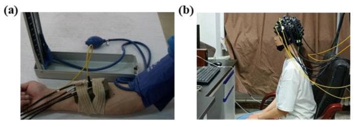 A composite clinical photograph illustrating experimental setups for hemodynamic monitoring. Figure (a) displays a vascular occlusion experiment on a human forearm. A blue pneumatic blood pressure cuff is positioned on the upper arm, connected to a manual bulb and mercury sphygmomanometer. Attached distal to the cuff on the forearm is a multi-channel functional Near-Infrared Spectroscopy (fNIRS) probe, secured with a tan elastic bandage. The probe features multiple black and yellow optical fiber cables for data acquisition. Figure (b) depicts a subject seated during a Valsalva maneuver experiment. The subject wears a specialized fNIRS headgear cap embedded with numerous sensor nodes and optical fibers (black and yellow) extending posteriorly. The setup is located in a controlled laboratory environment with a computer workstation. These images demonstrate procedural applications of continuous-wave fNIRS technology for monitoring peripheral and cerebral hemodynamic changes (oxy- and deoxy-hemoglobin) during physiological stress tests.