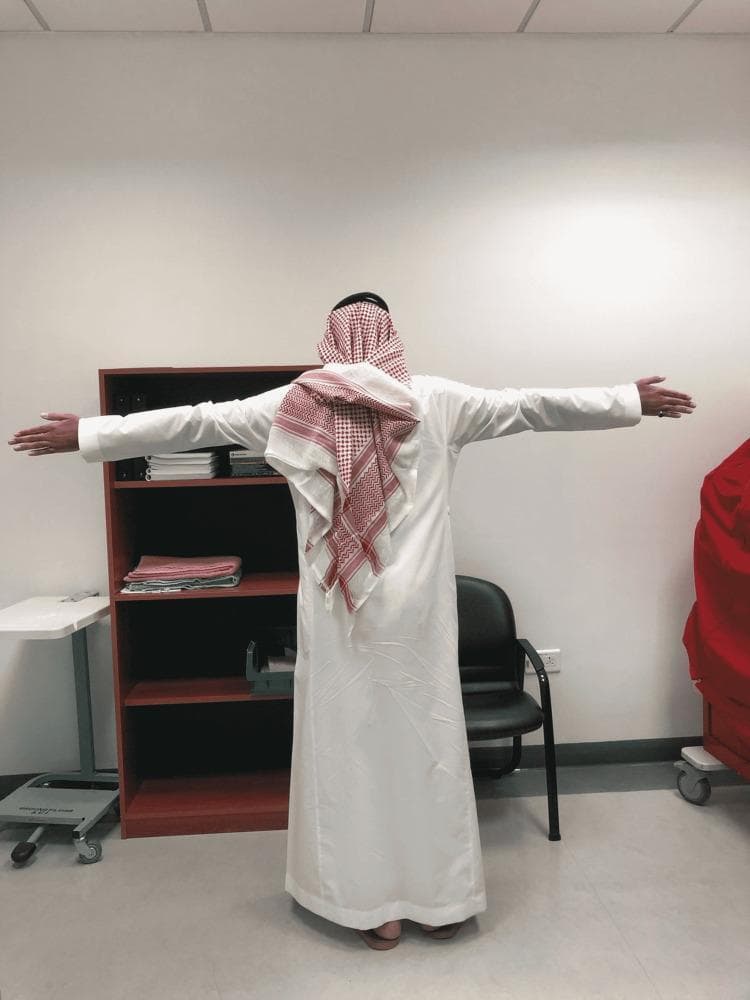 Clinical photograph of a patient viewed from behind, demonstrating Marfanoid habitus. The subject is standing with arms abducted to 90 degrees, highlighting a disproportionately long arm span in relation to total height. Key anatomical features include tall stature (dolichostenomelia) and long upper extremities, which are hallmarks of connective tissue disorders such as Marfan syndrome. The patient is wearing traditional Middle Eastern attire, including a white thobe and a red-and-white checkered ghutrah. This visual serves to illustrate the clinical assessment of body proportions and skeletal manifestations in medical genetics and internal medicine. The image emphasizes the increased arm-span-to-height ratio, an important clinical diagnostic criterion for identifying tall stature syndromes.