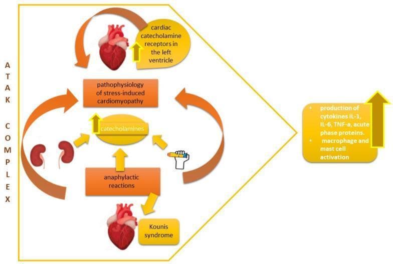 This pathophysiology diagram illustrates the 'ATAK complex', a multifaceted clinical entity involving the interplay between anaphylaxis, Takotsubo syndrome, and Kounis syndrome. The central mechanism highlights the surge of catecholamines, which links anaphylactic reactions to the pathophysiology of stress-induced cardiomyopathy. The visual layout features anatomical illustrations of the heart and kidneys, connected by orange bidirectional arrows indicating systemic feedback loops. Key components include: 1) Cardiac catecholamine receptors in the left ventricle, 2) Kounis syndrome arising from allergic myocardial ischemia, 3) Kidney involvement in systemic stress, and 4) Anaphylactic reactions triggered by external agents (depicted by an epinephrine autoinjector icon). On the right, the diagram emphasizes a massive inflammatory response characterized by increased production of cytokines (IL-1, IL-6, TNF-α), acute phase proteins, and the activation of macrophages and mast cells. This educational schematic is used to demonstrate how hypersensitivity and adrenergic surges converge to cause acute cardiac dysfunction, relevant to cardiology and immunology specialties.