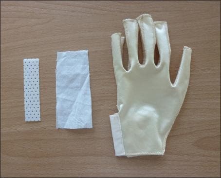 A clinical photograph displaying the components of a modified pressure garment system used in rehabilitative medicine for burn scar management and hand therapy. On a neutral background, three items are arranged horizontally: a rectangular strip of white, perforated thermoplastic material used for rigid splinting; a rectangular piece of soft, white cloth used for creating external pockets on the garment; and a cream-colored, synthetic elastane pressure glove. The glove features a distal open-finger design (open fingertips) to allow for digital circulation monitoring and sensory feedback. The garment construction includes visible seams for anatomical contouring and a lateral wrist opening secured with a hook-and-loop strap. This modified system is designed to integrate thermoplastic splints with compression therapy to prevent hypertrophic scar contractures and maintain finger extension while improving patient compliance.