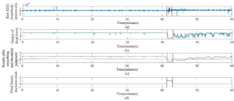 Hugging Face pmc clinical VQA raw