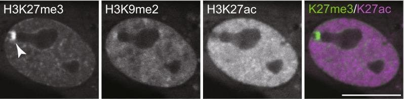 This set of four diagnostic fluorescence images demonstrates the live-cell imaging of histone modifications in a human hTERT-RPE1 nucleus using Fab-based live endogenous modification labeling (FabLEM). Three individual channels show different histone marks: H3K27me3 (trimethylation associated with gene silencing), H3K9me2 (dimethylation), and H3K27ac (acetylation associated with active transcription).
The H3K27me3 channel exhibits a highly concentrated, localized signal (indicated by an arrowhead), which identifies the inactive X chromosome. In contrast, the H3K27ac channel shows a broad, uniform distribution across the nucleus but is distinctly excluded from the inactive X chromosome territory. The H3K9me2 channel shows a relatively uniform nuclear distribution with slight enrichment in the same region as K27me3. A fourth composite image overlays H3K27me3 (green) and H3K27ac (magenta), highlighting the mutual spatial exclusion between these epigenetic marks. This visual comparison illustrates the organization of chromatin into distinct functional domains, specifically contrasting heterochromatin (inactive) and euchromatin (active) states within a living human cell.
