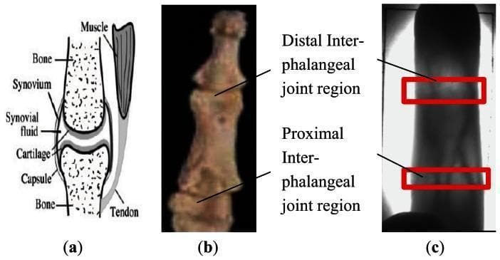 This figure presents a multi-part educational visual detailing the anatomy and imaging characteristics of human phalangeal joints. Panel (a) is an anatomical diagram of a diarthrodial joint, labeling the bone, articular cartilage, synovium, synovial fluid within the articular cavity, joint capsule, muscle, and tendon. It illustrates the spatial relationship between these connective tissues and the skeletal structure. Panel (b) shows a clinical photograph of a phalanx specimen, highlighting the distal and proximal joint locations. Panel (c) is a near-infrared (NIR) finger vein diagnostic image. It demonstrates the clinical significance of joint anatomy in biometric imaging; the distal and proximal inter-phalangeal joint regions are highlighted with red rectangles. These areas appear brighter due to the lower density of synovial fluid compared to bone, allowing greater NIR light penetration. This visual is designed for medical education regarding hand anatomy, musculoskeletal structures, and the application of physiological properties in diagnostic or biometric imaging systems.