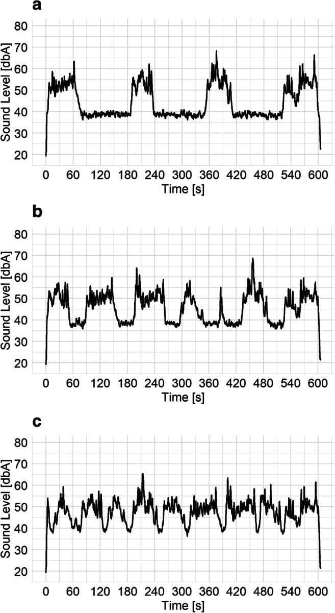 This Comparison Chart consists of three line graphs (a, b, and c) illustrating sound level variations over a 600-second (10-minute) duration, used in environmental health research to evaluate human noise annoyance and psychoacoustics. Each graph plots A-weighted sound levels (dBA) on the y-axis (20–80 dBA) against time on the x-axis.
Graph (a) demonstrates intermittent sound patterns with a 50% proportion, showing distinct high-amplitude clusters reaching 60–70 dBA separated by stable baseline 'quiet' periods of 40 dBA. Graph (b) represents a 75% proportion, showing more frequent peaks with shorter intervals of background noise. Graph (c) illustrates a 100% continuous proportion, characterized by constant fluctuations between 40 and 65 dBA without stable baseline periods.
The visual data is clinically relevant for studying auditory perception, environmental stressors, and the physiological impact of traffic-related noise. It specifically highlights the concepts of 'intermittency' and 'roughness' in sound stimuli, providing a basis for understanding how different temporal patterns of noise exposure influence subjective human annoyance levels and potential occupational or environmental health outcomes.