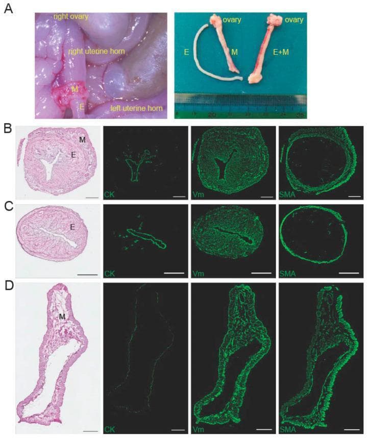 This composite educational graphic illustrates the surgical isolation and histological characterization of the rat endometrium for biomedical research. Panel A contains clinical photographs of the dissection process: the left image shows the in-situ separation of the endometrium (E) from the myometrium (M) within the uterine horn; the right image displays the isolated components (E, M, and intact E+M) alongside a metric scale. Panels B, C, and D present comparative cross-sectional histology (H&E stain) and immunofluorescence (IF) microscopy (scale bars = 500 µm). Panel B (Whole Uterus) shows intact luminal and muscular layers with cytokeratin (CK) highlighting the epithelium, vimentin (Vm) in the stroma and muscle, and smooth muscle actin (SMA) localized to the outer myometrium. Panel C (Peeled Endometrium) demonstrates a CK-positive epithelial lining and Vm-positive stroma, but an absence of SMA, confirming successful separation from the muscularis. Panel D (Remaining Outer Layer) shows a thick, SMA-positive and Vm-positive myometrial wall lacking internal CK-positive epithelial structures. These findings validate a method for isolating intact endometrial tissue for regenerative medicine studies.