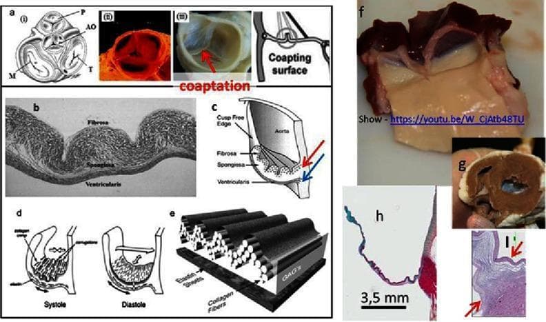 A multi-panel educational graphic illustrating the anatomy, histology, and biomechanics of heart valves. Panels a-i through a-iii show clinical and schematic views of the four cardiac valves (Pulmonary, Aortic, Mitral, Tricuspid) and a decellularized porcine valve. Histological section (b) and diagram (c) identify the three-layered structure of the valve leaflet: the fibrosa (outer layer, rich in circumferentially oriented collagen), spongiosa (middle layer, containing glycosaminoglycans/GAGs for shock absorption), and ventricularis (inner layer, rich in radially oriented elastin). Panels (d) and (e) demonstrate the mechanical behavior of these layers during the cardiac cycle, showing how collagen and elastin fibers accommodate stress during systole and diastole. Panel (f) provides a gross photograph of a sheep aortic valve from the ventricular side, while (h) presents a histological stain (likely Movat's pentachrome) highlighting GAGs in blue within the spongiosa. Panel (i) shows the hinge area histology, emphasizing the complex fiber arrangement necessary for valvular durability and function.