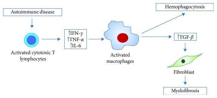 A pathophysiology diagram illustrating the proposed mechanism for coexisting hemophagocytosis and myelofibrosis, specifically in the context of Systemic Lupus Erythematosus (SLE). The process begins with an autoimmune disease trigger that leads to the activation of cytotoxic T lymphocytes. These activated cells release pro-inflammatory cytokines, specifically IFN-gamma, TNF-alpha, and IL-6 (all indicated with upward-facing arrows denoting increased levels). These cytokines then stimulate macrophages, which transition into an activated state. The activated macrophages drive two simultaneous pathways: 1) the direct clinical phenomenon of hemophagocytosis, and 2) the increased production of TGF-beta. The elevated TGF-beta acts upon fibroblasts (depicted as green spindle-shaped cells), stimulating their proliferation and activity, which ultimately results in myelofibrosis. The diagram uses flow arrows to establish a clear sequential relationship between immune activation, cytokine signaling, and tissue-level pathology, highlighting the dual outcomes of hypercytokinemia in hematopoietic and stromal environments.