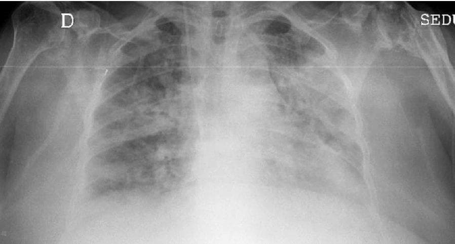 Hugging Face pmc clinical VQA raw