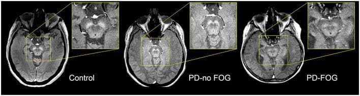 Hugging Face pmc clinical VQA raw