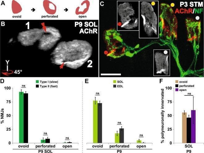 This composite educational image illustrates the maturation of postsynaptic acetylcholine receptor (AChR) aggregates at the neuromuscular junction (NMJ) and its relationship to synapse elimination. Panel A provides a schematic of morphological progression from ovoid plaque to perforated plaque to an open configuration. Panel B displays grayscale confocal images of P9 mouse soleus AChR aggregates, rotated 45 degrees to highlight central perforations (red arrows). Panel C shows a fluorescence micrograph of P3 sternomastoid NMJs labeled for AChR (red) and Neurofilament (green), demonstrating varied maturation stages: open (red dot), perforated (yellow dot), and ovoid (grey dot) within polyneuronally innervated synapses. Panels D and E are bar graphs comparing AChR maturation across muscle fiber types (Type I vs. Type II) and muscles (Soleus vs. EDL), showing no significant difference ('ns'). Panel F quantifies that the percentage of polyneuronally innervated NMJs does not significantly differ based on postsynaptic morphology. The data indicates that postsynaptic AChR maturation occurs independently of the timing of axonal input removal during development.