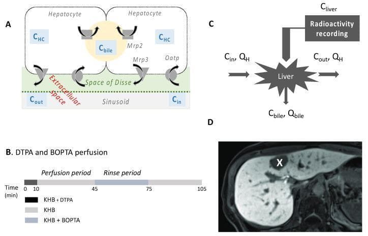 A multi-panel figure illustrating the transport mechanisms and diagnostic application of gadobenic acid (BOPTA) in hepatobiliary imaging. Panel A is a pathophysiology diagram showing hepatocyte transport: BOPTA enters hepatocytes from the sinusoids and space of Disse via Oatp transporters and exits into bile canaliculi through Mrp2, or returns to sinusoids via Mrp3. Panel B displays an experimental timeline for rat liver perfusion, detailing a 105-minute sequence involving KHB+DTPA (0-10 min), a KHB rinse (10-45 min), KHB+BOPTA accumulation (45-75 min), and a final rinse (75-105 min). Panel C is a schematic of a perfusion model indicating inflow (Cin), outflow (Cout), bile flow (Cbile), and radioactivity recording (Cliver) parameters. Panel D is a diagnostic MRI of a human liver in the hepatobiliary phase. It demonstrates differential uptake: normal hepatocytes appear bright (white) due to BOPTA uptake, while a focal liver lesion (marked with a 'X') remains dark (black), indicating a lack of uptake transporters in the tumor tissue.