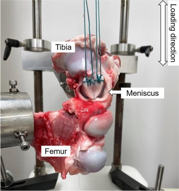 A biomechanical testing setup for an orthopedic study on knee joint meniscal repair. The clinical photograph shows a dissected knee joint specimen with the femur and tibia secured in custom-made metal jigs within a mechanical testing apparatus. The femur is oriented horizontally while the tibia is positioned vertically at the top. Between the articular surfaces of the bones, a dissected meniscus is visible, featuring green polyester sutures (No. 5 Ethibond) applied using the Krackow stitch technique at both ends of the tissue. These sutures are vertically tensioned and connected to an upper load cell jig, facilitating a tensile load-to-failure or cyclic loading test. An arrow in the top right corner indicates the vertical loading direction. The image illustrates a musculoskeletal research model used to evaluate the biomechanical stability and gap formation of various meniscal stitching techniques, such as inside-out repairs involving the peripheral meniscus and joint capsule.