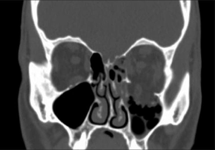 Hugging Face pmc clinical VQA raw
