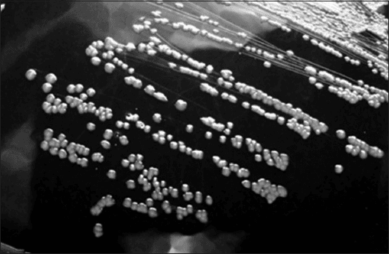 **Modality:** Microbiology culture photograph (grayscale).
**Specimen:** *Corynebacterium pseudotuberculosis* (formerly *Corynebacterium ovis*) isolated on blood agar medium.
**Morphological Features:** The image displays a streak plate demonstrating isolated bacterial colonies. The colonies are characterized by a distinct circular morphology with an entire margin. They exhibit a convex elevation and appear opaque with a grayish-white coloration against the dark background of the agar. The surface texture of the colonies appears slightly dry or waxy, which is characteristic of this genus.
**Distribution:** Streaking pattern shows confluent growth in the primary sectors transitioning to well-defined, discrete individual colonies in the peripheral sectors, allowing for the observation of specific colony macro-morphology.
**Diagnostic Context:** These visual features are consistent with the growth characteristics of *Corynebacterium* species, typically found in veterinary clinical microbiology samples. Key differentiating features include the specific convex profile and circular uniformity of the colonies on enriched media.